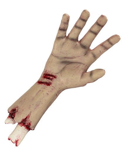 Abgehacktes Autopsie Hand mit Unterarm