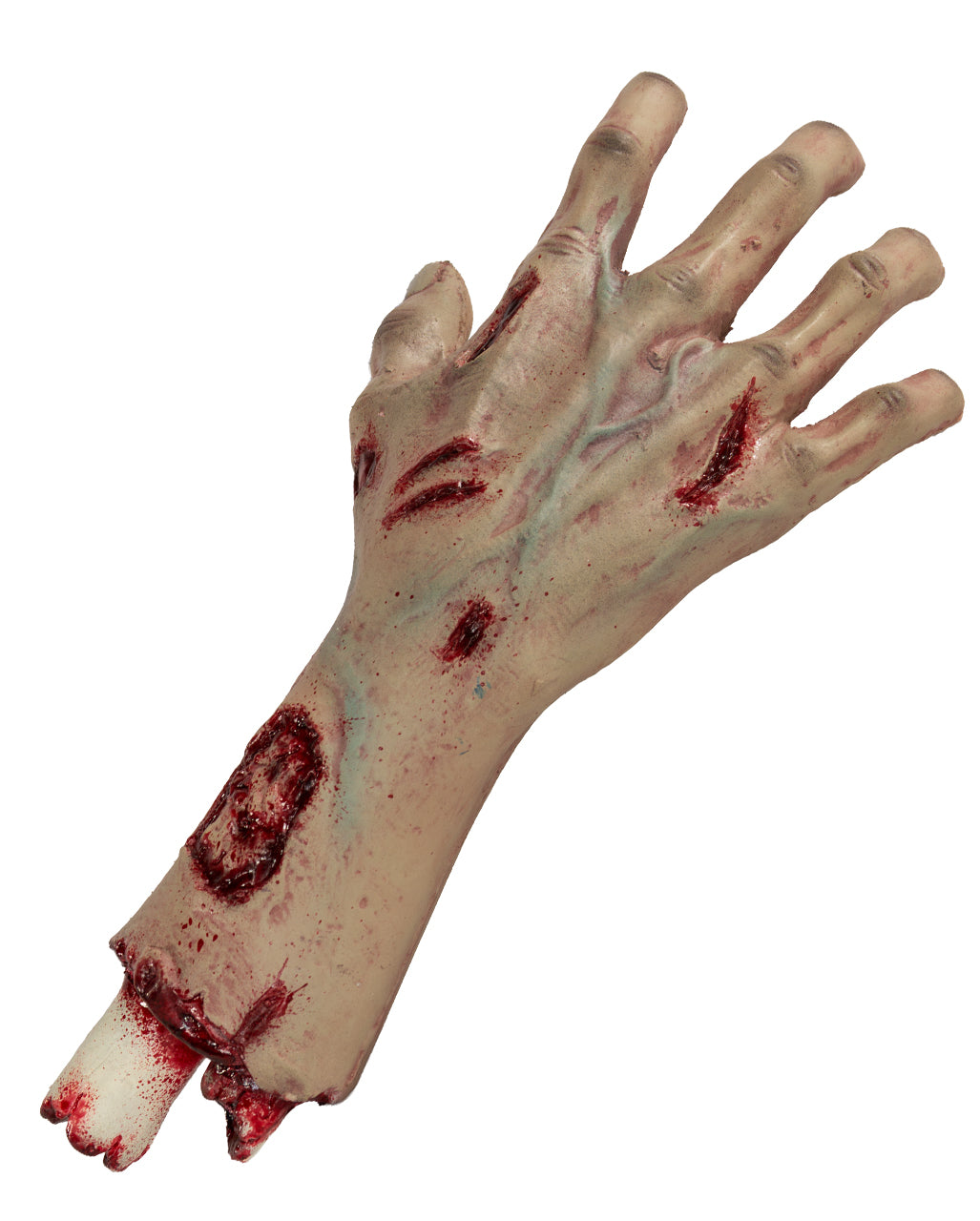 Abgehacktes Autopsie Hand mit Unterarm