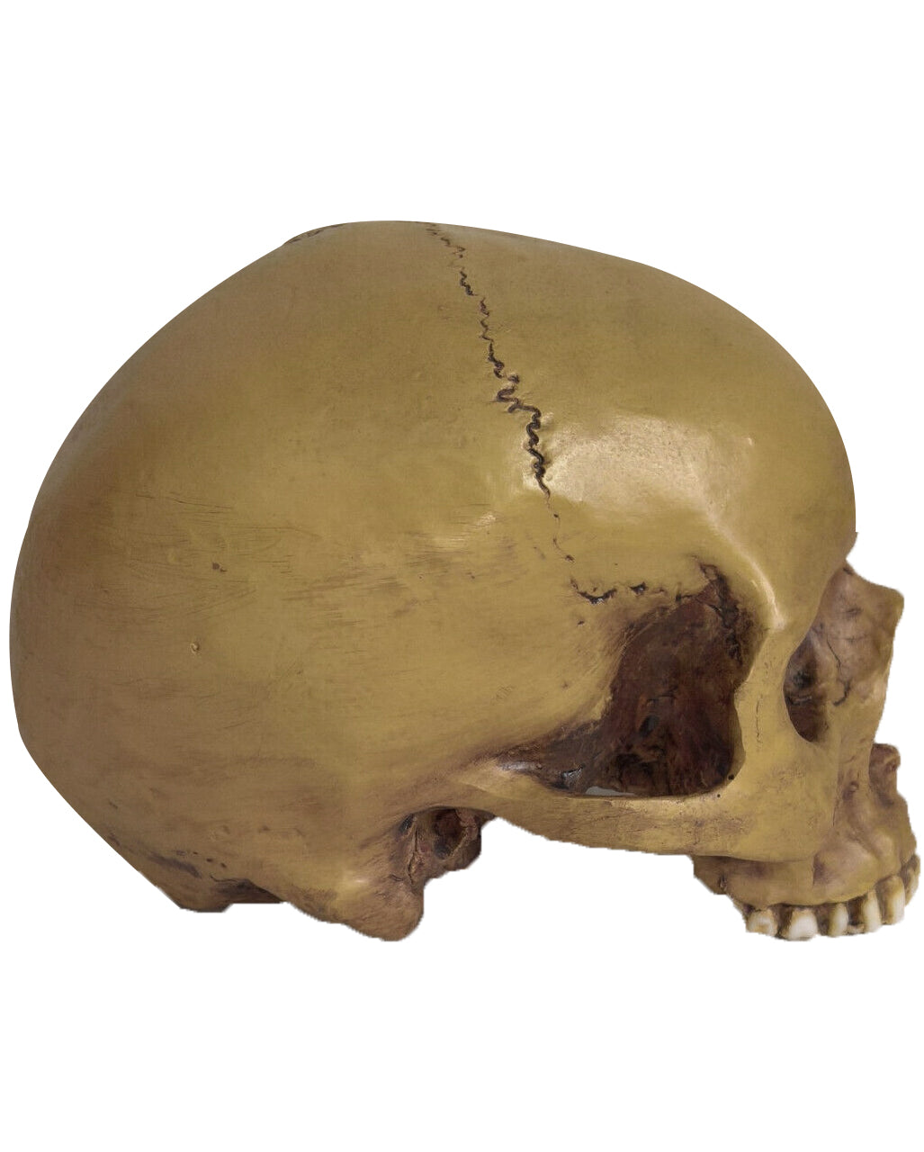 Antique Skull Without Lower Jaw 19cm