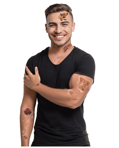 Infizierte Wunden Klebetattoos